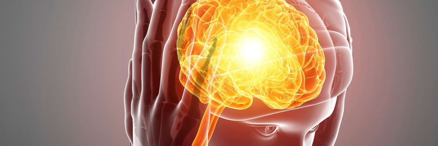 Migraine Self Assessment